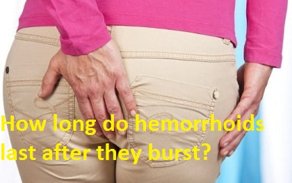 do hemorrhoids cause itching